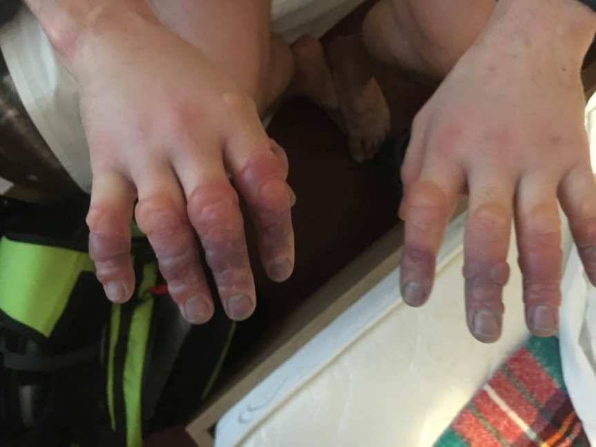 Ratownicy GOPR ratowali turystów. Drastyczne zdjęcie ku przestrodze