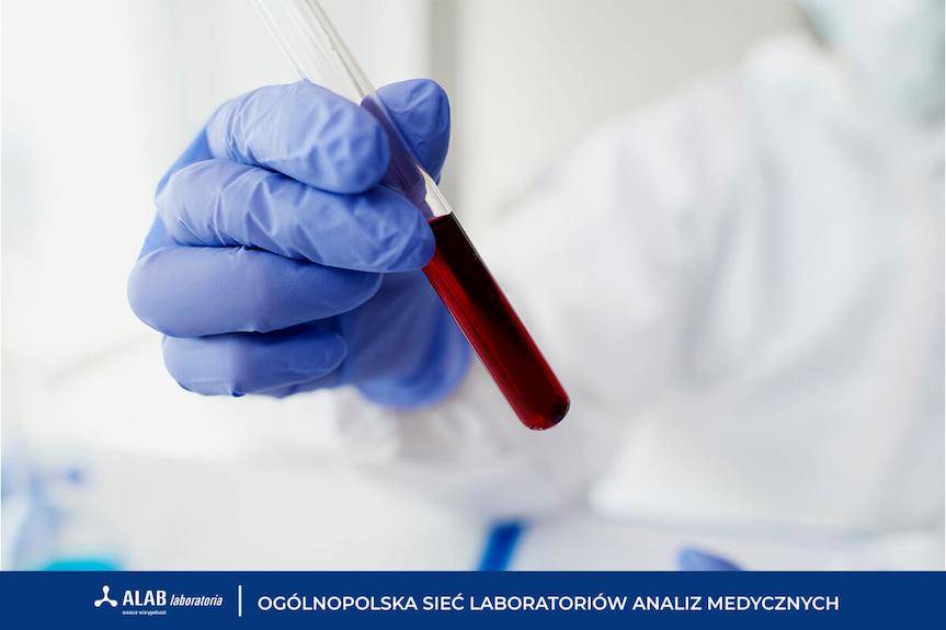 Morfologia krwi - w jakich sytuacjach wykonanie tego badania może okazać się konieczne?