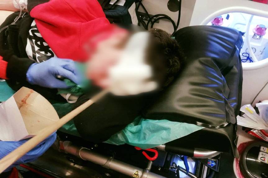 REGION. Nastolatek ze strzałą w głowie trafił do szpitala