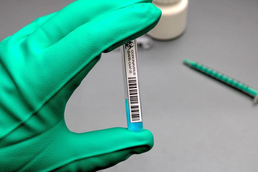 Szybkie testy na COVID-19 w szpitalu w Krośnie