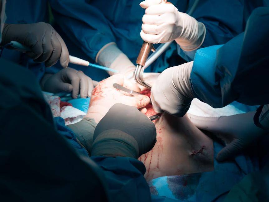 Rekordowa liczba zachorowań i zgonów na raka piersi