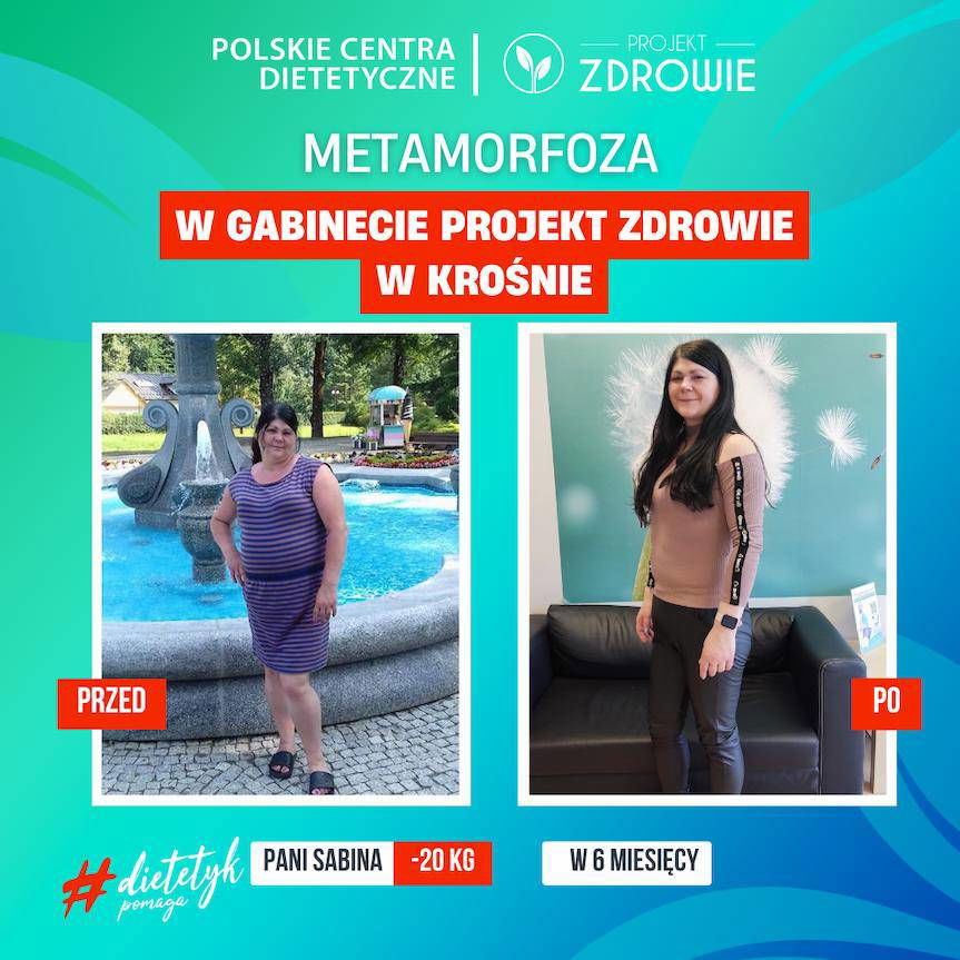 Skorzystaj z darmowych konsultacji w gabinecie Projekt Zdrowie w Krośnie