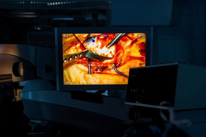 Nowatorska plomba podplamkowa. Pacjentka z Podkarpacia odzyska wzrok?